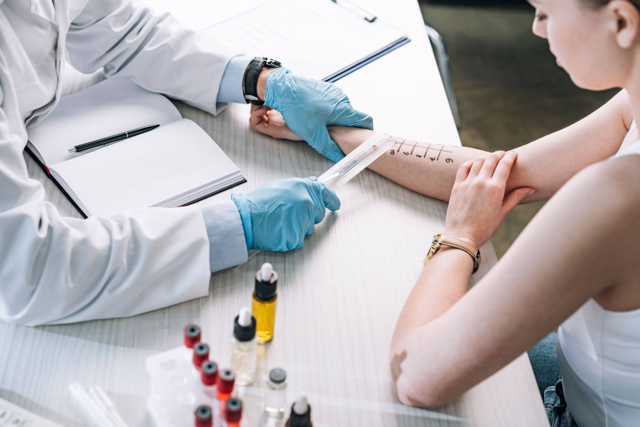 allergy test