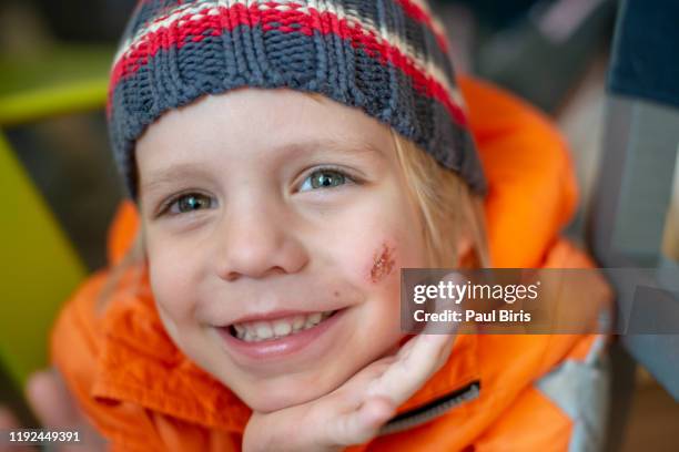 happy little boy with skin wound (abrasion) on the face - schnittwunde stock-fotos und bilder