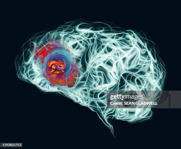 headache at front of brain - hirntumor stock-fotos und bilder