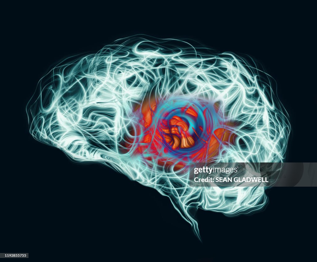 Headache in middle of brain