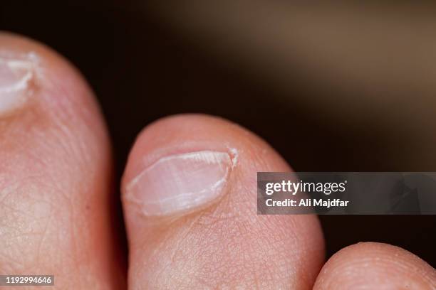 Hi Resolution Toes Foot Toes High-Res Stock Photo - Getty Images
