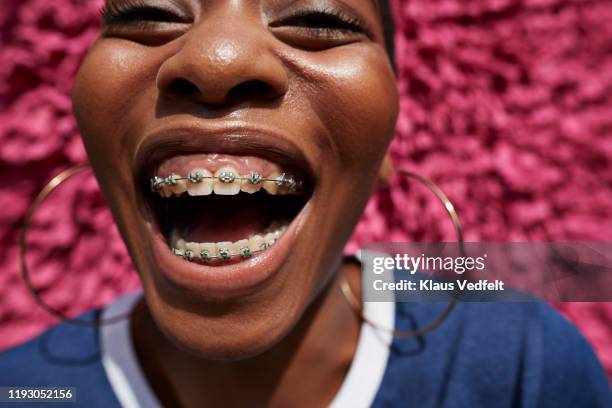 close-up of woman with braces against textured wall - adult retainer stockfoto's en -beelden