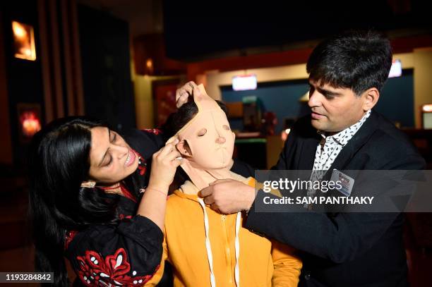 Milind Shah, Founder Chairman of Being Patient Foundation along with his wife Viral Shah help an acid attack survivor to wear a pressure garment,...