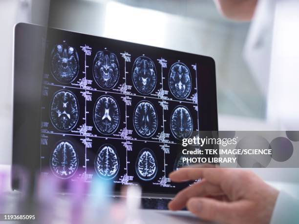 neurology diagnosis - dementia test stock pictures, royalty-free photos & images