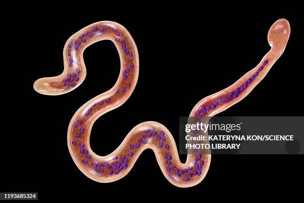 brugia malayi parasitic worm, illustration - roundworm stock-grafiken, -clipart, -cartoons und -symbole