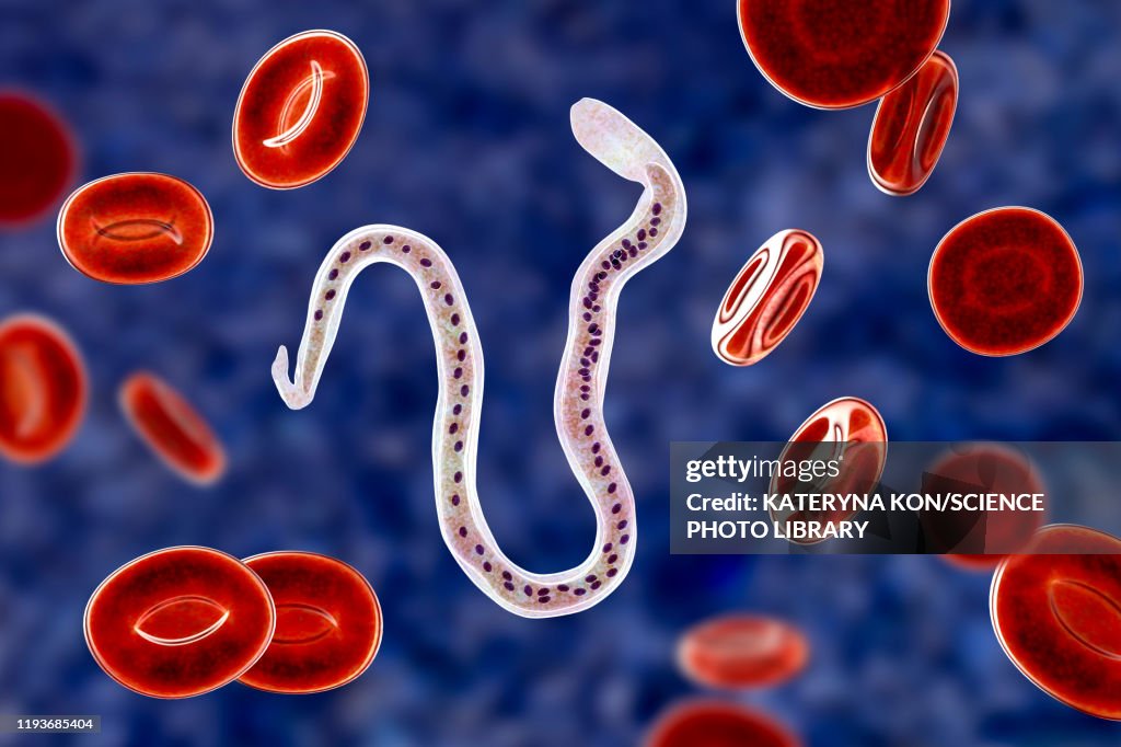 Wuchereria bancrofti parasite, illustration