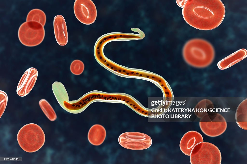 Wuchereria bancrofti parasite, illustration