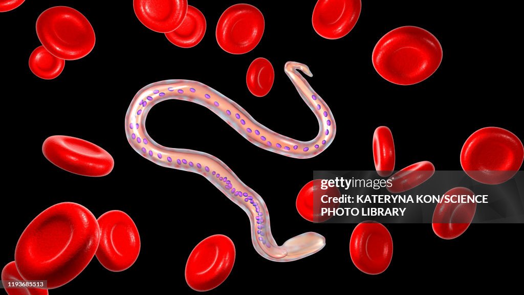 Wuchereria bancrofti parasite, illustration