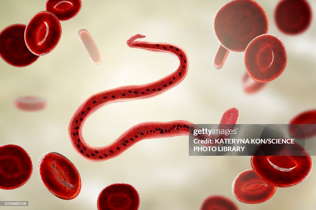 Wuchereria bancrofti parasite, illustration