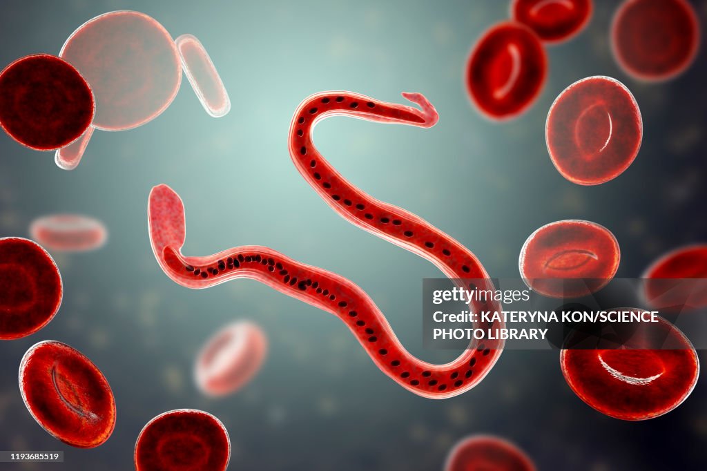 Wuchereria bancrofti parasite, illustration