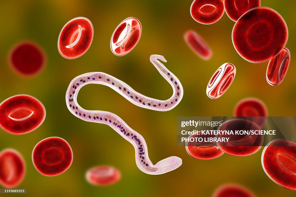Wuchereria bancrofti parasite, illustration