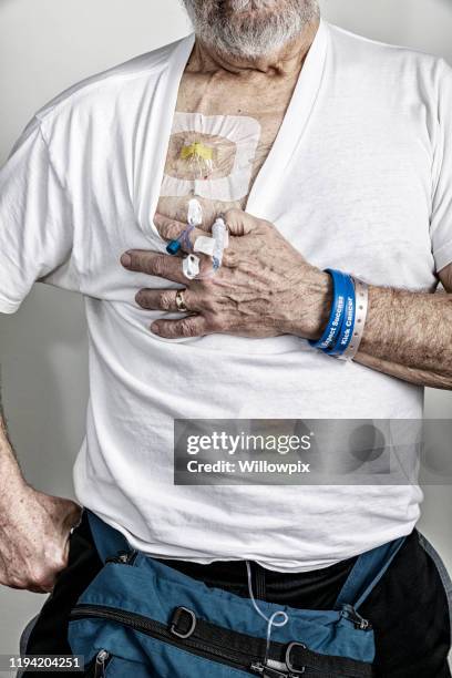 portable chemotherapy medicine iv pump cancer patient - iv pump stock pictures, royalty-free photos & images