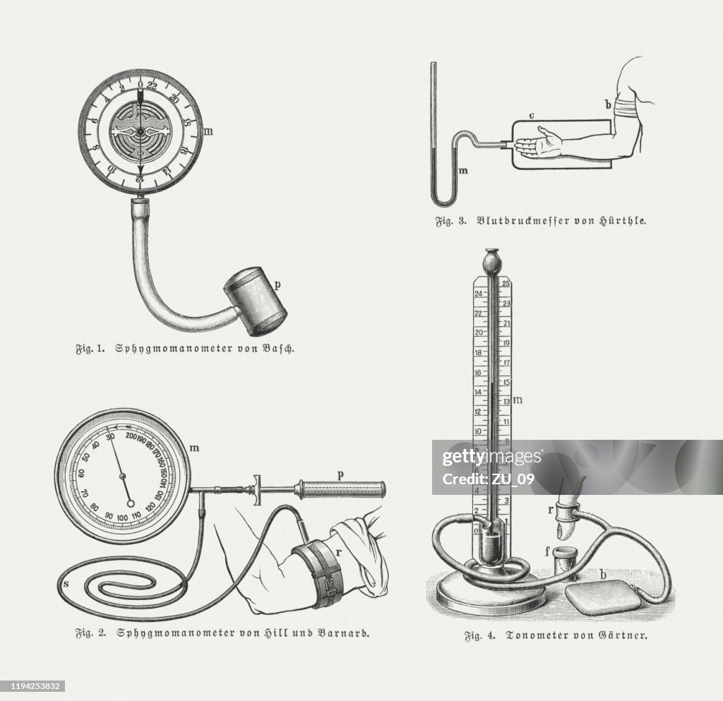 Historical blood pressure measurement, wood engravings, published in 1900