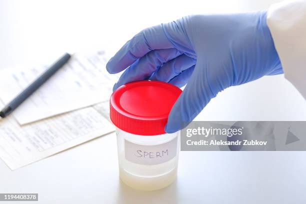 the doctor places a medical container labeled semen analysis next to the completed form on a white background. donor sperm for artificial insemination, infertility treatment, child planning. - spermatozoide stockfoto's en -beelden