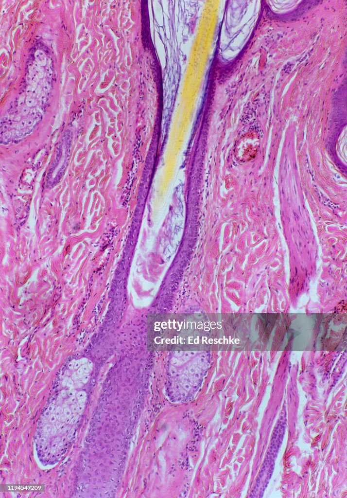 HAIR FOLLICLE, SEBACEOUS GLANDS, ARRECTOR PILI---Human Scalp, 25X