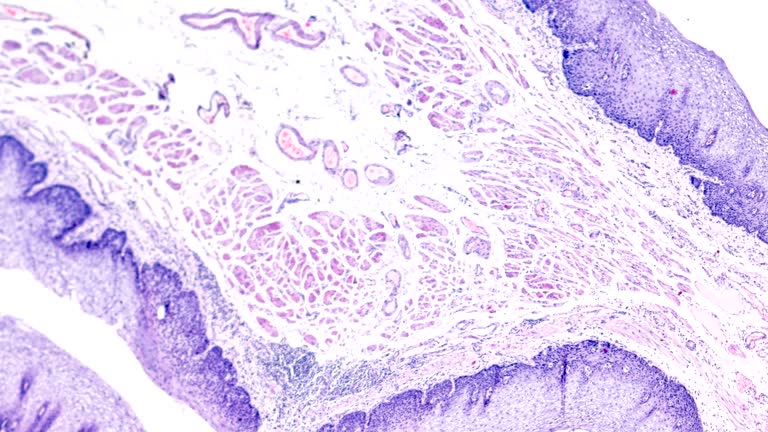Squamous Cell Microscope Squamous Cell Videos and HD Footage - Getty Images