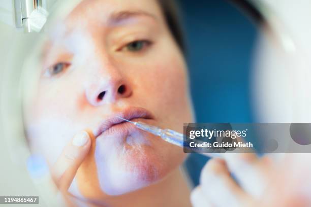High Re Injection Woman Doing Hyaluronic Acid Injection In Lips High-Res Stock Photo ...