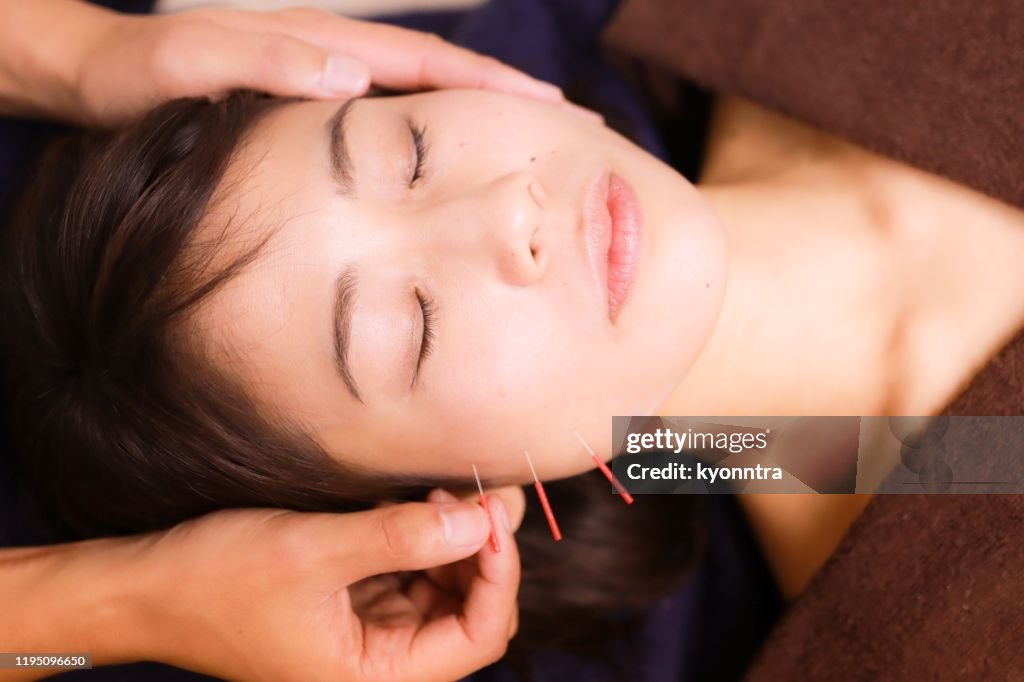 アジアの化粧品鍼