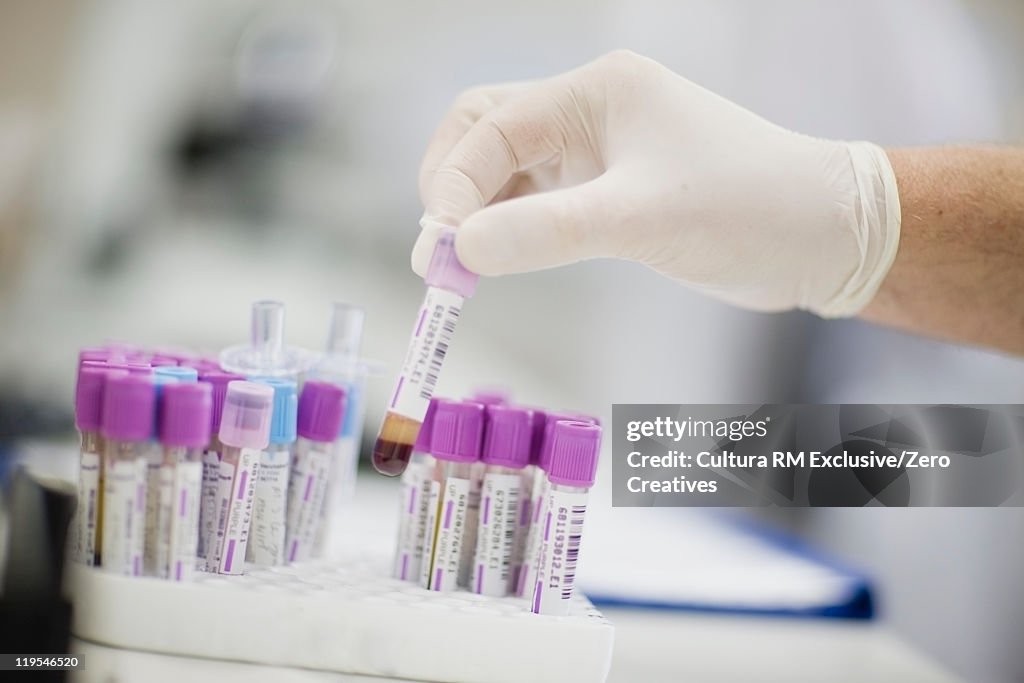 Scientist selecting test tube in lab