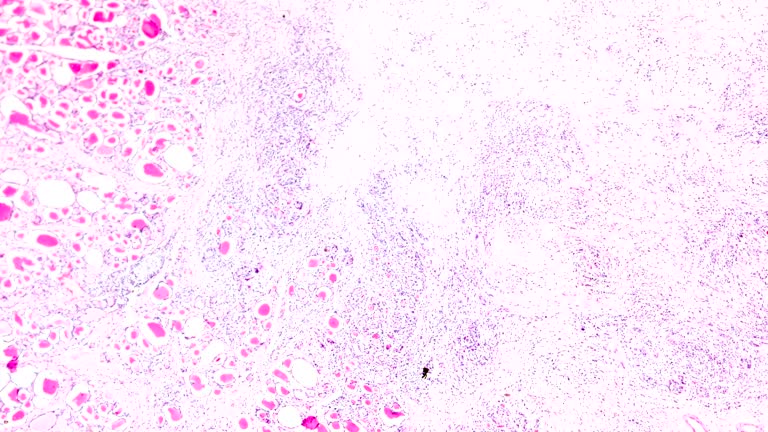 52 Thyroid Gland Histology Stock Videos, Footage, & 4K Video Clips ...