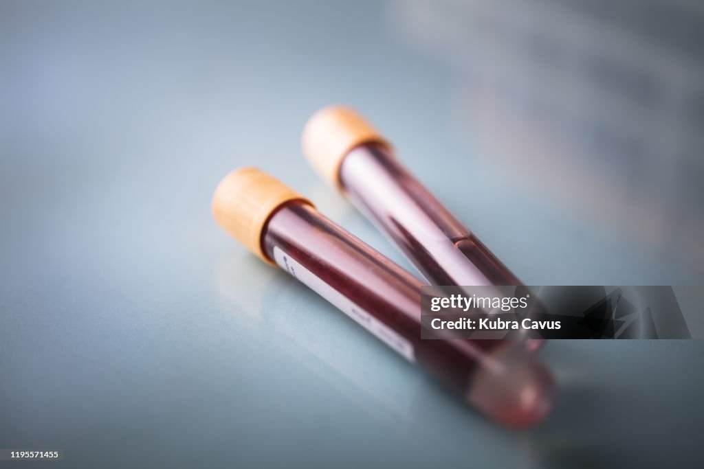 Test tube and blood sample