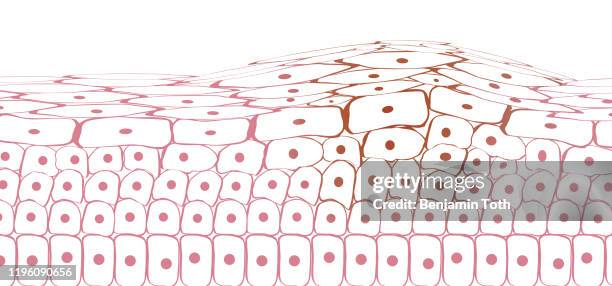 stockillustraties, clipart, cartoons en iconen met huid weefsel kankercellen, melanoom - cell structure