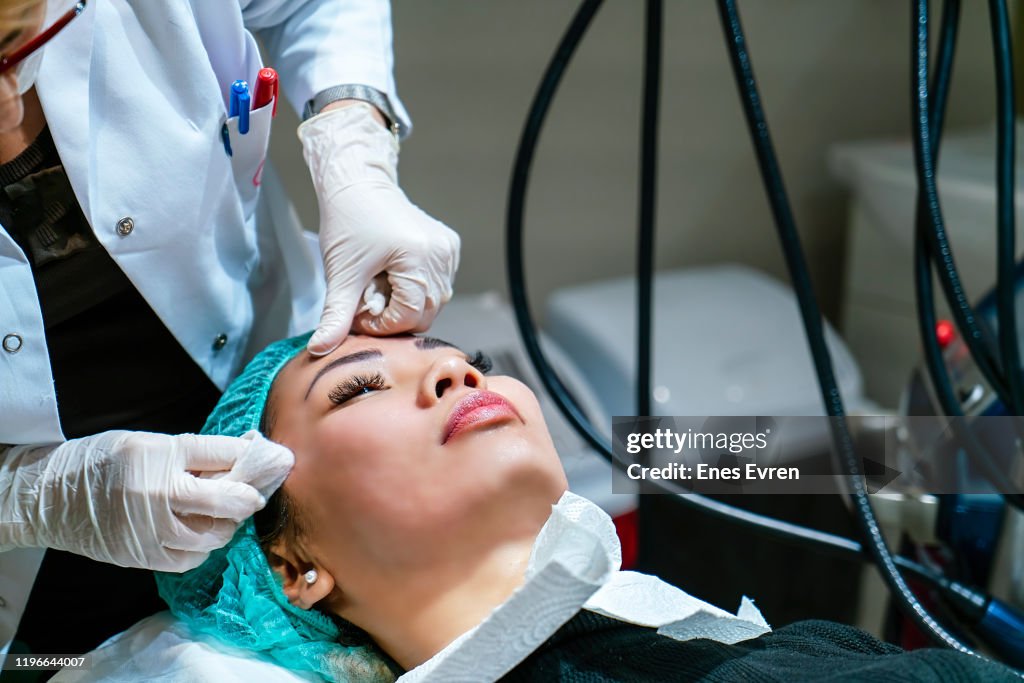 Intracel radiofrequency microneedling treatment