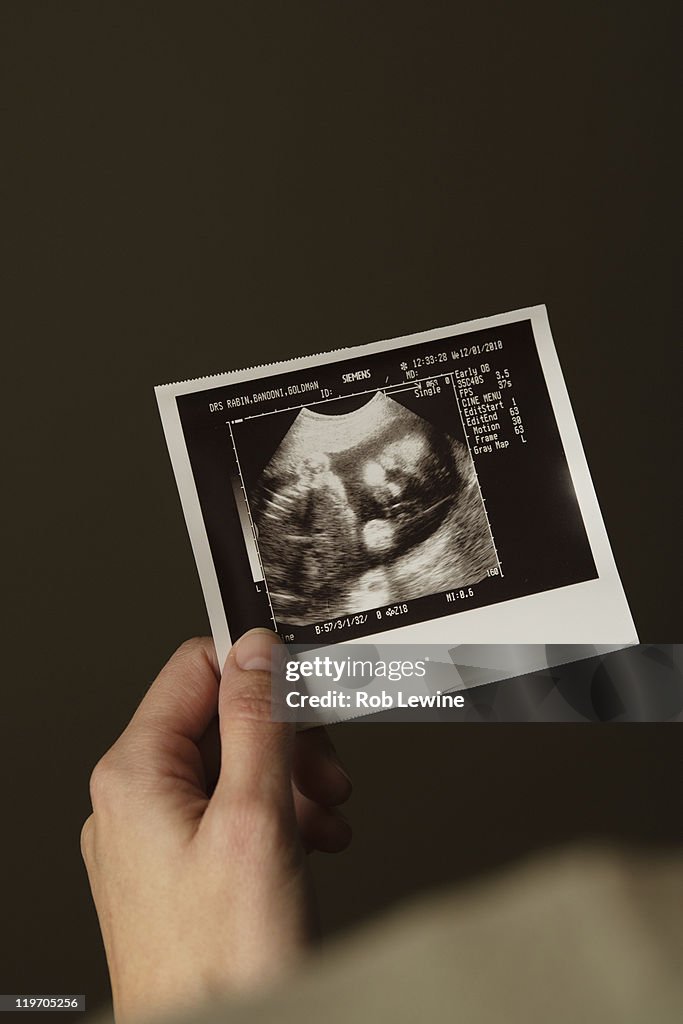 Woman holding ultrasonograph photo of baby