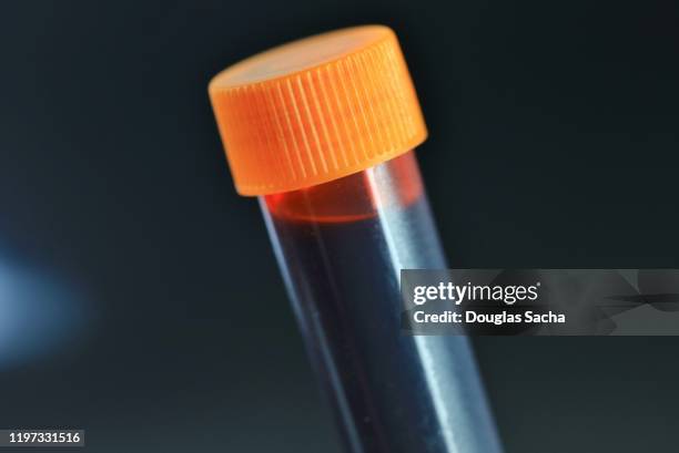 sample blood for testing - lipid stock-fotos und bilder