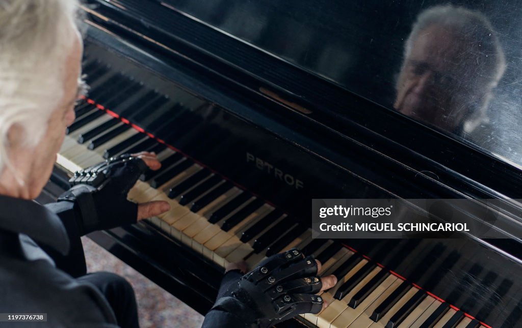 BRAZIL-MUSIC-HEALTH-SCIENCE-BIONIC-HANDS