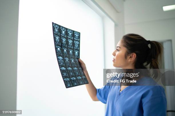 enfermeira fêmea que analisa o raio x médico - radiology - fotografias e filmes do acervo