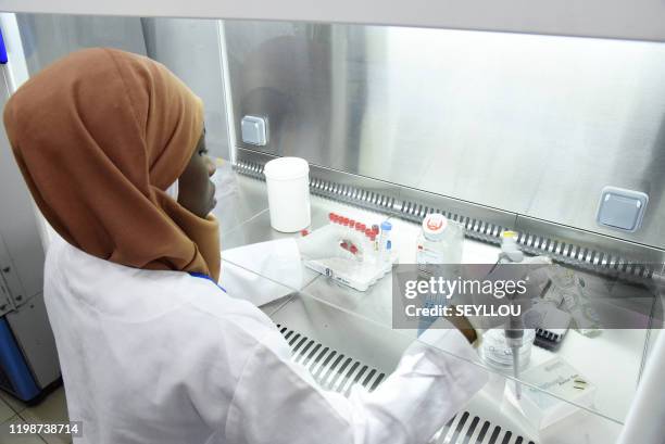 Scientific staff member works in a secure laboratory, researching the coronavirus, at the Pasteur Institute in Dakar on February 3, 2020. The Pasteur...