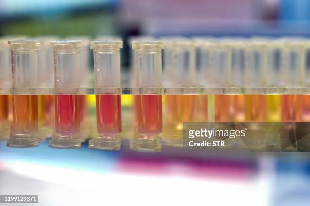 This photo taken on February 6, 2020 shows samples from people to be tested for the new coronavirus at "Fire Eye" laboratory in Wuhan in China's...