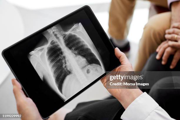 arts met medische x-ray door patiënt in ziekenhuis - long stockfoto's en -beelden