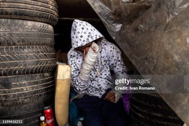 Algerian migrant named Adir in his shelter inside an abandoned industrial warehouse, with his arms in plaster, after the injuries suffered by the...