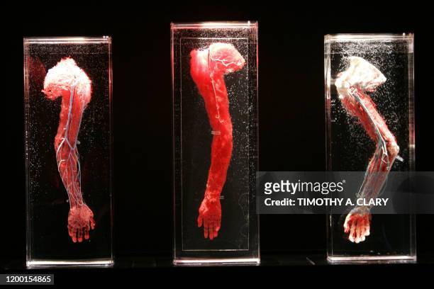 Human body parts showing the blood vessels are seen during an advance preview 16 November 2005 for "Bodies...The Exhibition" featuring real humans...