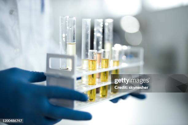 närbild av cbd-olja i provrör vid laboratoriet. - provrör bildbanksfoton och bilder