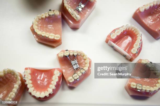 dental model molds on a table - dentadura postiza fotografías e imágenes de stock