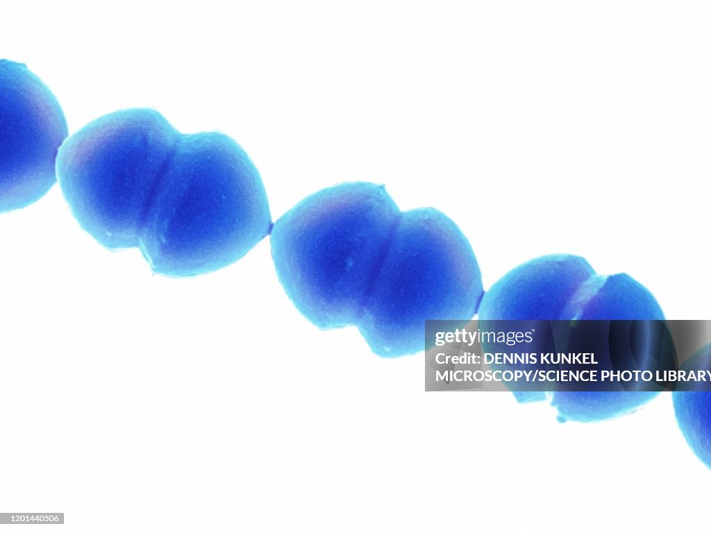 Enterococcus faecalis, SEM