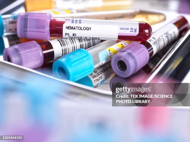 Medical Sample Collection 244 Urine Collection Stock Photos, High-Res Pictures, and Images ...