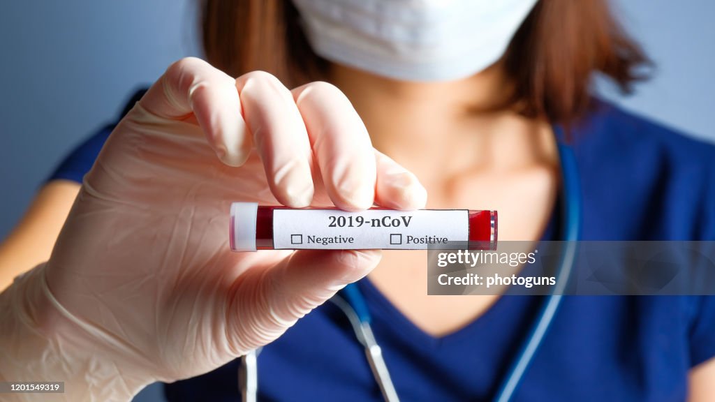 Nurse holding test tube with blood for 2019-nCoV analyzing. Novel Chinese Coronavirus blood test concept