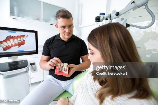 dentist explaining tooth implantation to woman patient - implante dentário imagens e fotografias de stock