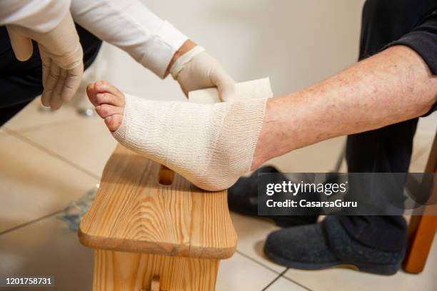 home caregiver helping senior woman to bandage her injured ankle - stock photo - twisted stock pictures, royalty-free photos & images