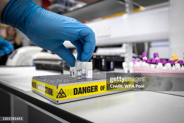 Coronavirus Testing Laboratory In Glasgow Coronavirus Testing Laboratory In Glasgow