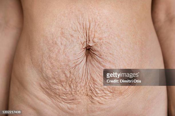mother's belly after childbirth - belly button stock pictures, royalty-free photos & images