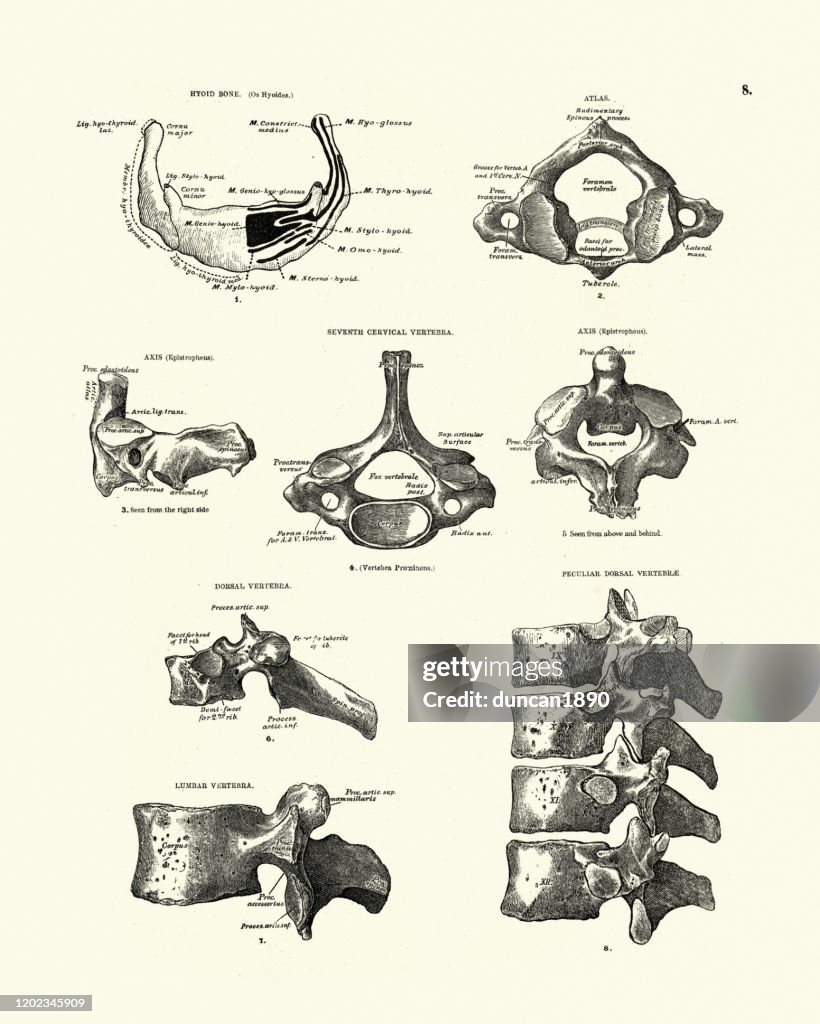 Hyoidknochen Atlas Siebter Halswirbel Viktorianische Anatomische ...