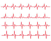 electro-cardiogram Line rhythm illustration material set