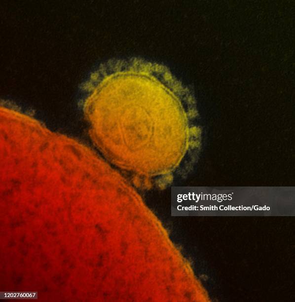 Highly magnified, digitally colorized transmission electron microscopic image, showing ultrastructural details exhibited by a single, spherical...