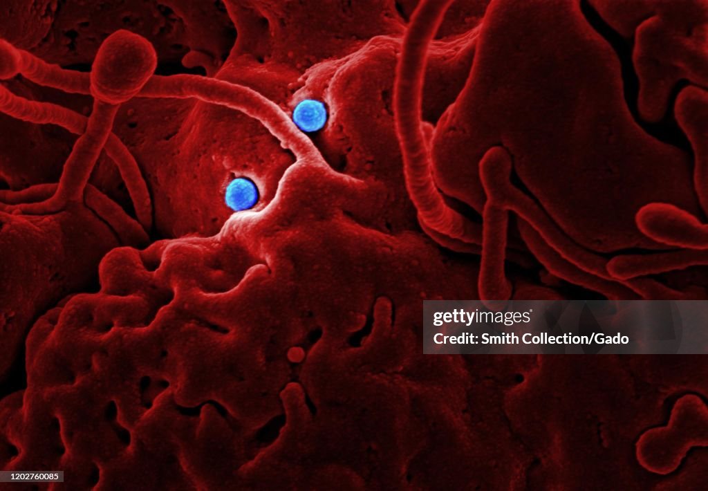 Coronavirus