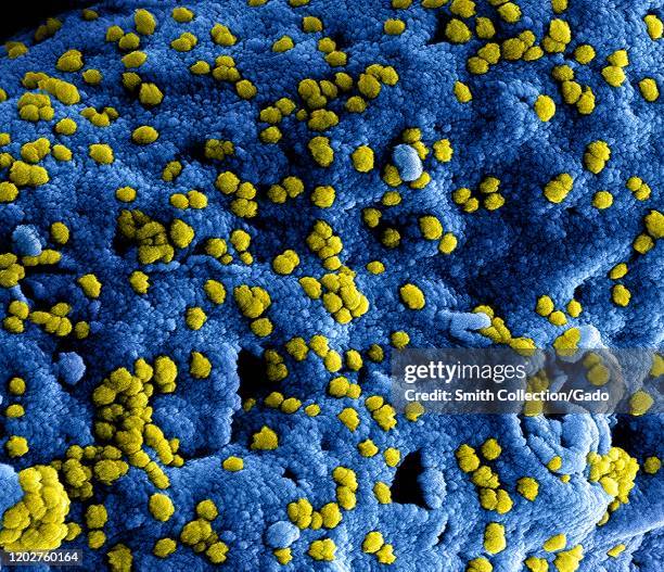 Highly magnified, digitally colorized scanning electron microscopic image, showing ultrastructural details at the site of interaction of numerous...